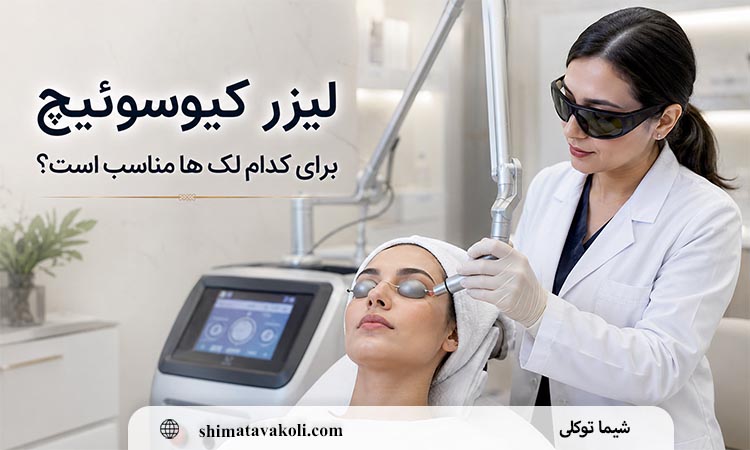 لیزر کیوسوئیچ برای کدام لک ها مناسب است؟