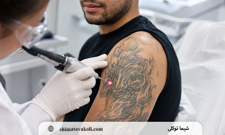 مراحل انجام، تعداد جلسات و زمان مشاهده نتیجه