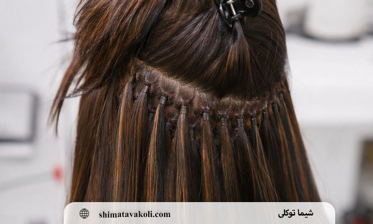 چه علائمی بعد از اکستنشن نیاز به بررسی متخصص دارد؟