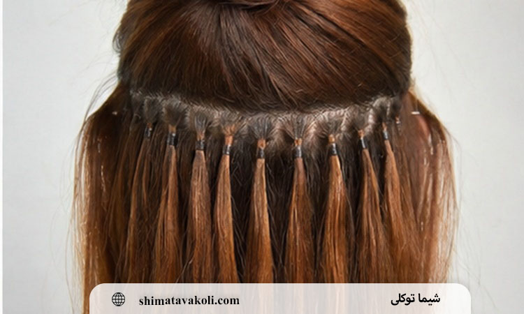 سردرد و کشیدگی پوست سر بعد از اکستنشن؛ چه مقدار طبیعی است و چه زمانی نصب باید اصلاح شود؟
